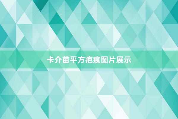 卡介苗平方疤痕图片展示